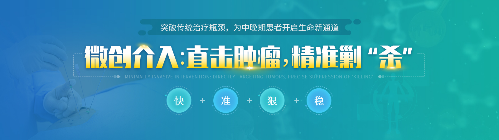 微创介入
